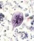 Giardia lamblia (Lamblia intestinalis)