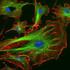 Das Cytoskelett eukaryotischer Zellen (ein dynamisches, filamentöses Netzwerk)
