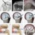 Arthroskopische Schulter-Operation mit / ohne Rotatorenmanschettenruptur Orthopädie