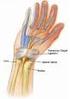 CTS (Carpal-Tunnel-Syndrom)