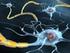 Können wir die Nervenzellen mit Medikamenten reparieren?