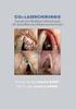 Onkologische Ergebnisse nach Laserchirurgie glottischer Larynxkarzinome - Eine retrospektive Analyse