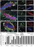 Regulation der Expression von multiple drug resistance (mdr) Effluxpumpen in klinisch relevanten Salmonella-Stämmen