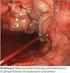 Endoskopische Diagnostik und Therapie bei akuter gastrointestinaler Blutung. C. Hirschi, Gastroenterologie KSL