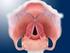 Erkrankungen des Larynx