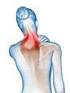 Schulter- und Nackenschmerzen Schmerzen in den Armen Hüft- und Ischiasschmerzen Knie- und Gelenkschmerzen Durchblutungsstörungen.