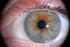 Was die Iris zeigt Welche Informationen die Iris liefert Psychosomatische Betrachtungsweise. Kapitel 1 Was das Auge erzählt - Die Gesundheit im Auge