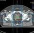 3D-konformale Strahlentherapie Intensitätsmodulierte Strahlentherapie - IMRT