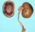 Einleitung zu Pathologie der Niere