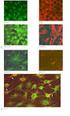 Dissertation. Das Zytoskelett der Endothelzelle: Bedeutung des Mikrotubulus- und Mikrofilamentsystems für die Regulation der Endothelpermeabilität