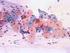 Mikroskopische und statistische. Auswertung der Auftretenshäufigkeit von Hensen-Körpern in. kochleären Haarzellen vom Meerschweinchen