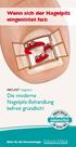 Wenn sich der Nagelpilz eingenistet hat: Nagellack. Die moderne Nagelpilz-Behandlung befreit gründlich!
