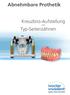 Kreuzbiss-Aufstellung mit Typ-Seitenzähnen. Abnehmbare Prothetik
