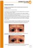 AESCHE. Patienteninformation. Korrektur mimisch bedingter Falten mit Botulinumtoxin A (ehemals als BOTOX bekannt)