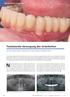 Festsitzende Versorgung des Unterkiefers. auf acht vollkeramischen Implantaten mit verschraubter Suprakonstruktion